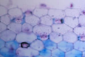Germ cell cancer is shown in a laboratory