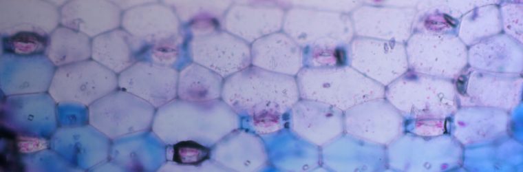 Germ cell cancer is shown in a laboratory