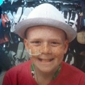 Kalem, wearing a white hat, smiles during treatment for non-hodgkin lymphoma.