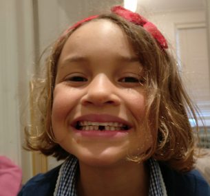 girl smiling with lost teeth