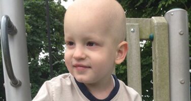 Dylan with no hair