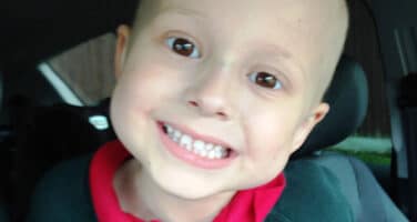 A child who started limping due to cancer