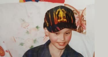 Darren during treatment