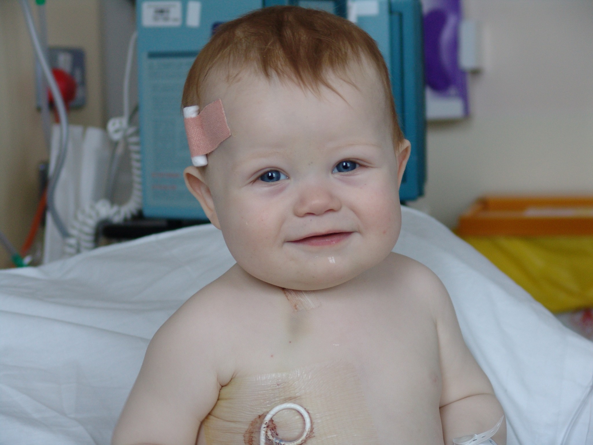 baby in hospital bed Day Ted Diagnosed