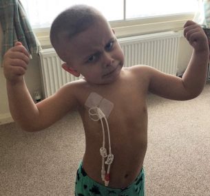 Boy with central line showing arm muscles