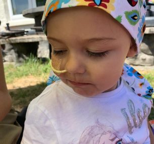 Girl with feeding tube and bandana