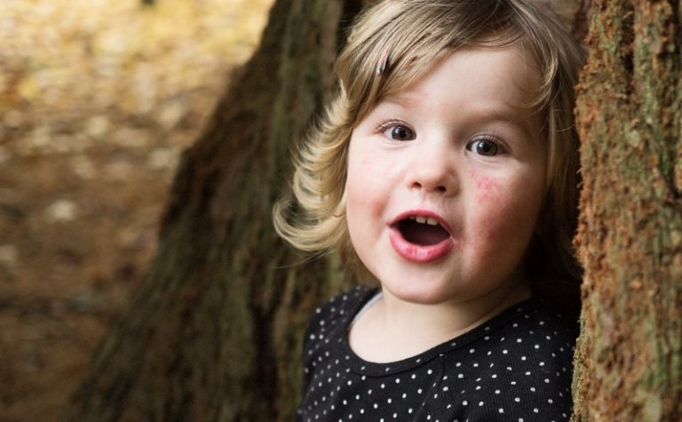 Izzy, who wasn't even two when she was diagnosed with leukaemia, smiles straight into the camera.