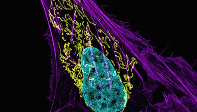 national cancer institute osteosarcoma