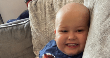 Theo smiling looking at camera with no hair