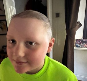 Aston with shaved head