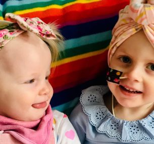 Matilda with nose tube and hair wrap with sister