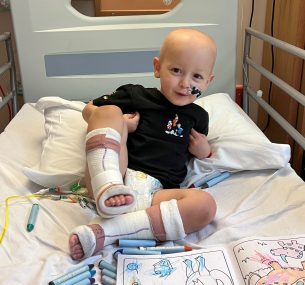 Thomas with leg casts in hospital bed
