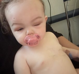 Nancy after her second surgery