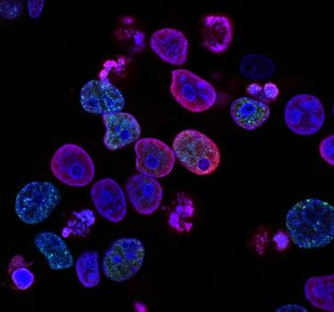 national cancer institute L7en7Lb Ovc unsplash