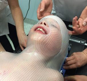 Leighton wearing CT scan mask.